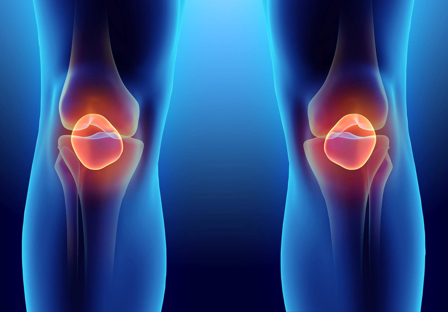Does ozone therapy help with osteoarthritis? - Blog