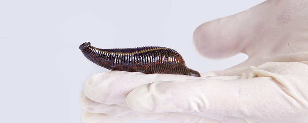 What helps with itching after leech therapy? - Blog
