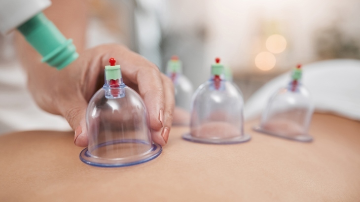 Why is Cupping Performed at Specific Times? - Blog