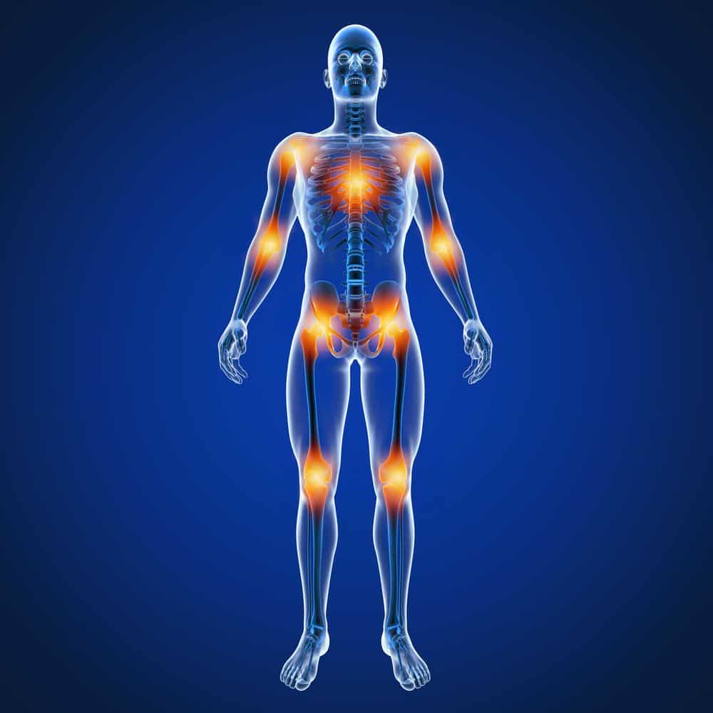 What Is Fibromyalgia? - Blog